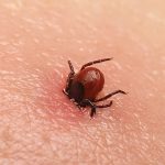 Fight the bite and protect yourself from ticks, diseases they carry